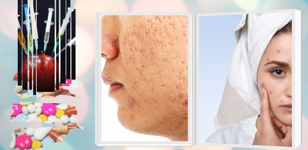 cover kosmetik