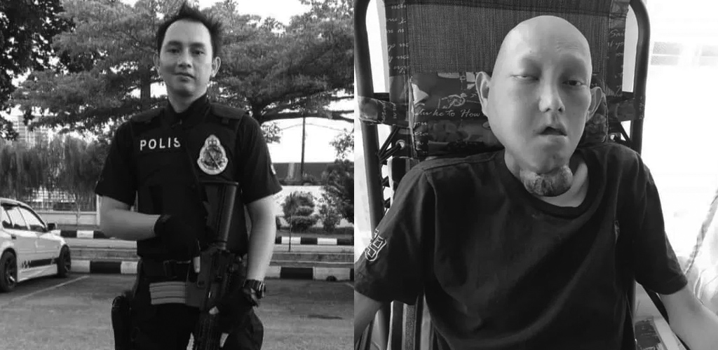 Capai hasrat bertemu rakan setugas, anggota polis hidap kanser rahang meninggal dunia