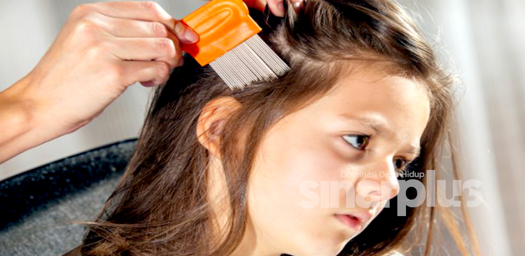 Si kecil dijangkiti kutu rambut, ini tip mudah yang boleh diambil