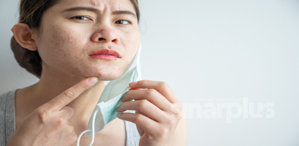 KKM kongsi 8 langkah pencegahan ‘mask acne’ akibat pemakaian pelitup muka
