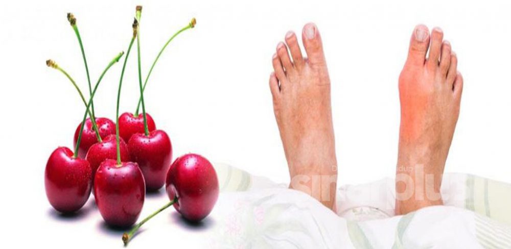 Buah ceri antara makanan yang boleh diambil untuk mencegah gout