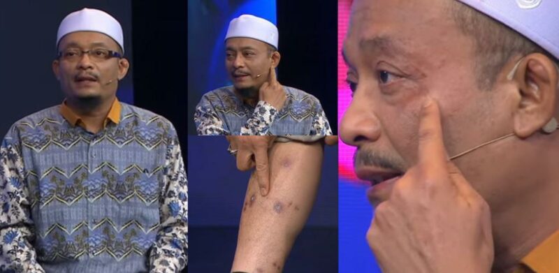 Sebulan tak boleh kencing, keluar jarum dari perut, Ustaz Kazim buang 'makeup', kongsi keadaan sebenar di live TV