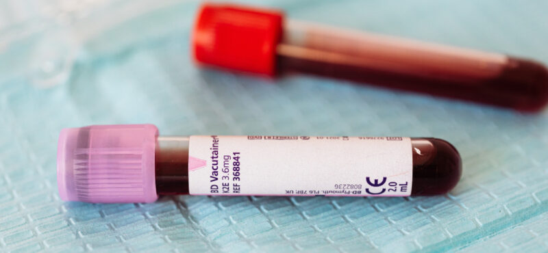 hepatitis (3)