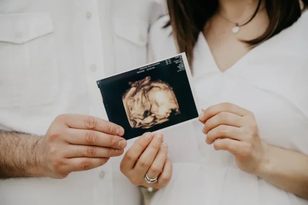 bayi ultrasoud