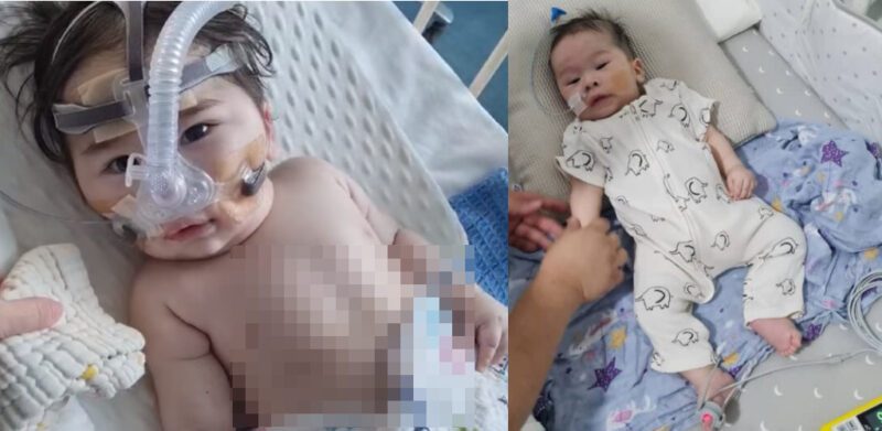 Terpaksa ditidurkan, tak dapat bernafas sendiri, bapa kongsi keadaan terkini Baby Naail & mohon doa